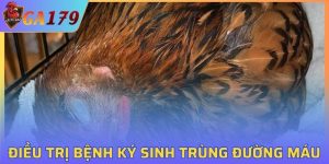 Bệnh Ký Sinh Trùng Đường Máu